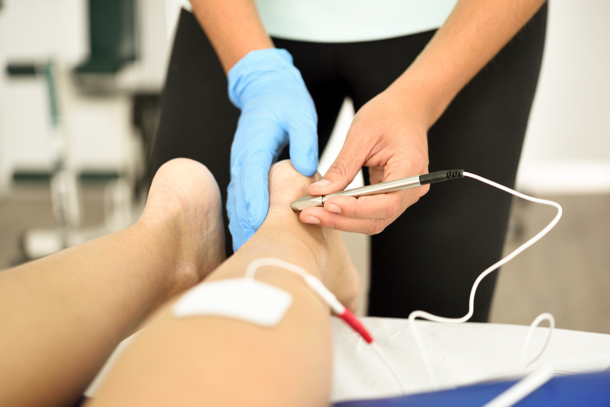 Electroacupuncture dry with needle on female ankle.