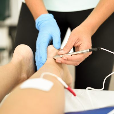 Electroacupuncture dry with needle on female ankle.